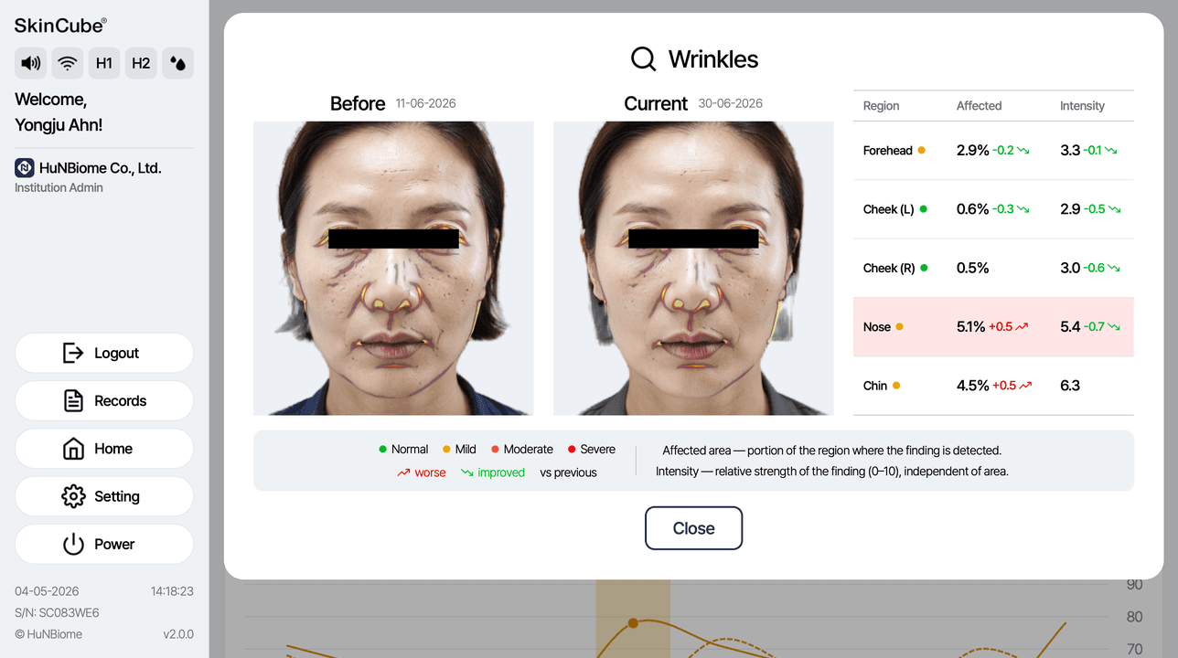 Face photo analysis