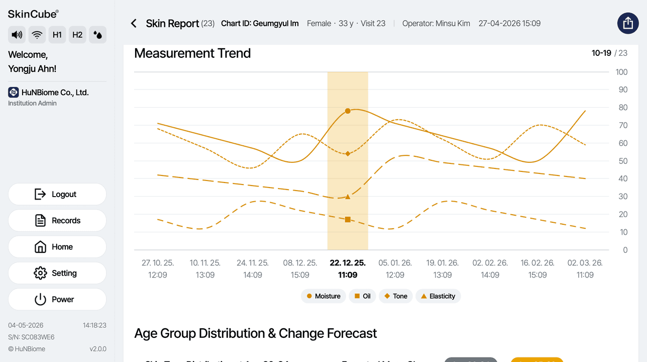 Measurement trend